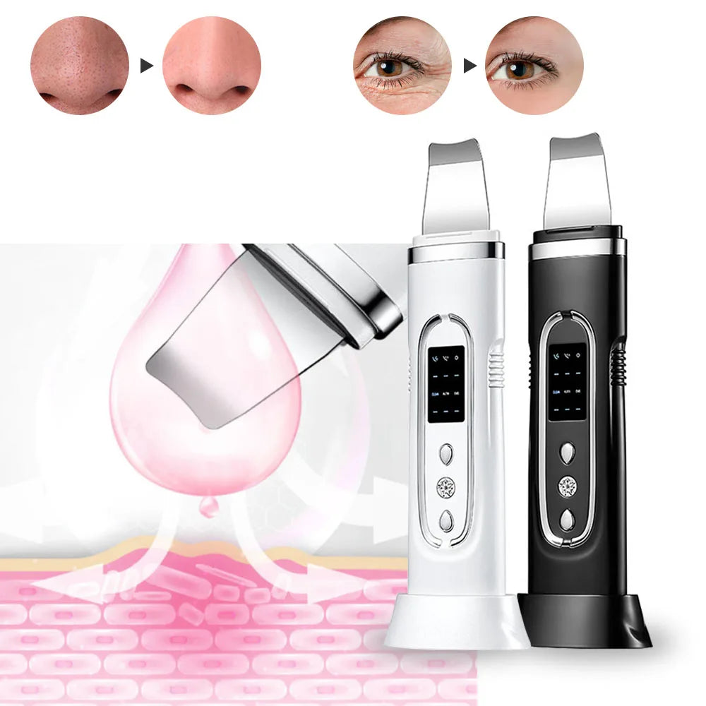 Ultrasonic Skin Scrubber & Blackhead Remover
