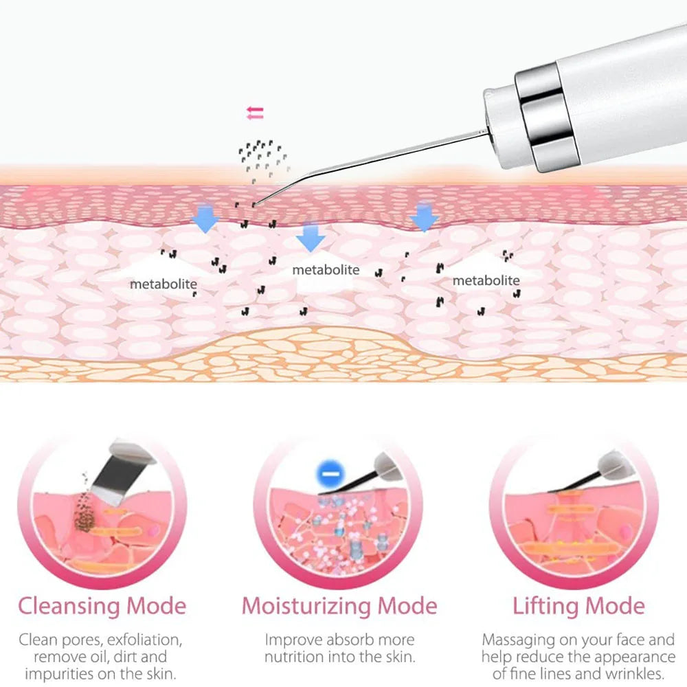 Ultrasonic Skin Scrubber & Blackhead Remover