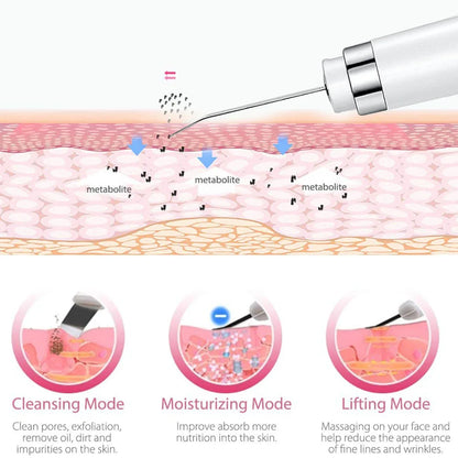 Ultrasonic Skin Scrubber & Blackhead Remover